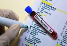 Анализ ЩФ, как индикатор здоровья